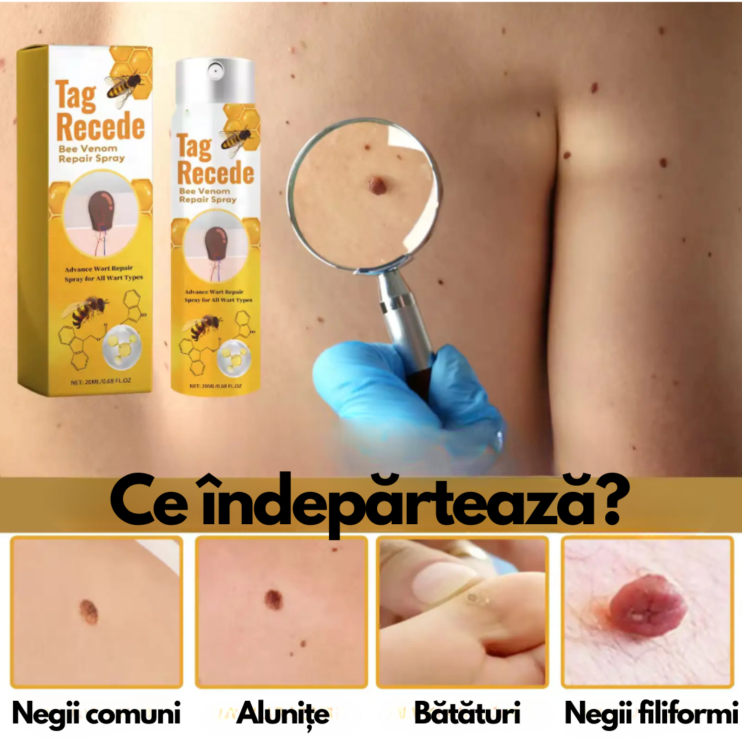 Apiderm-Spray cu Venin de Albine