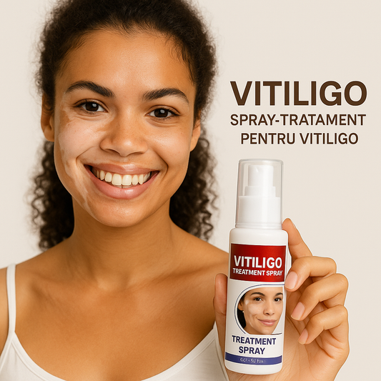 Vitiligo Spray-Tratament pentru VITILIGO