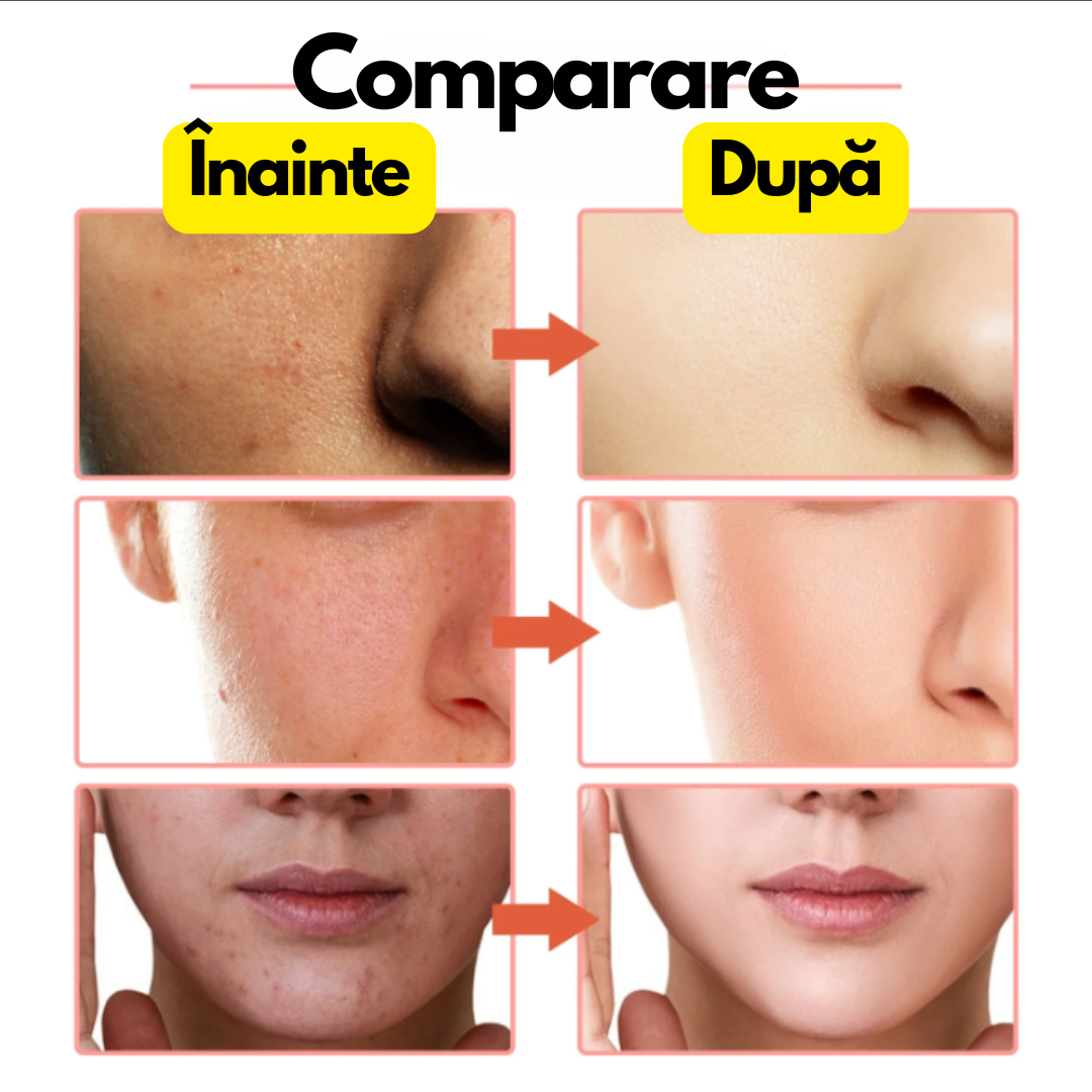 Ser Facial Anti-Pete cu Niacinamidă 5%