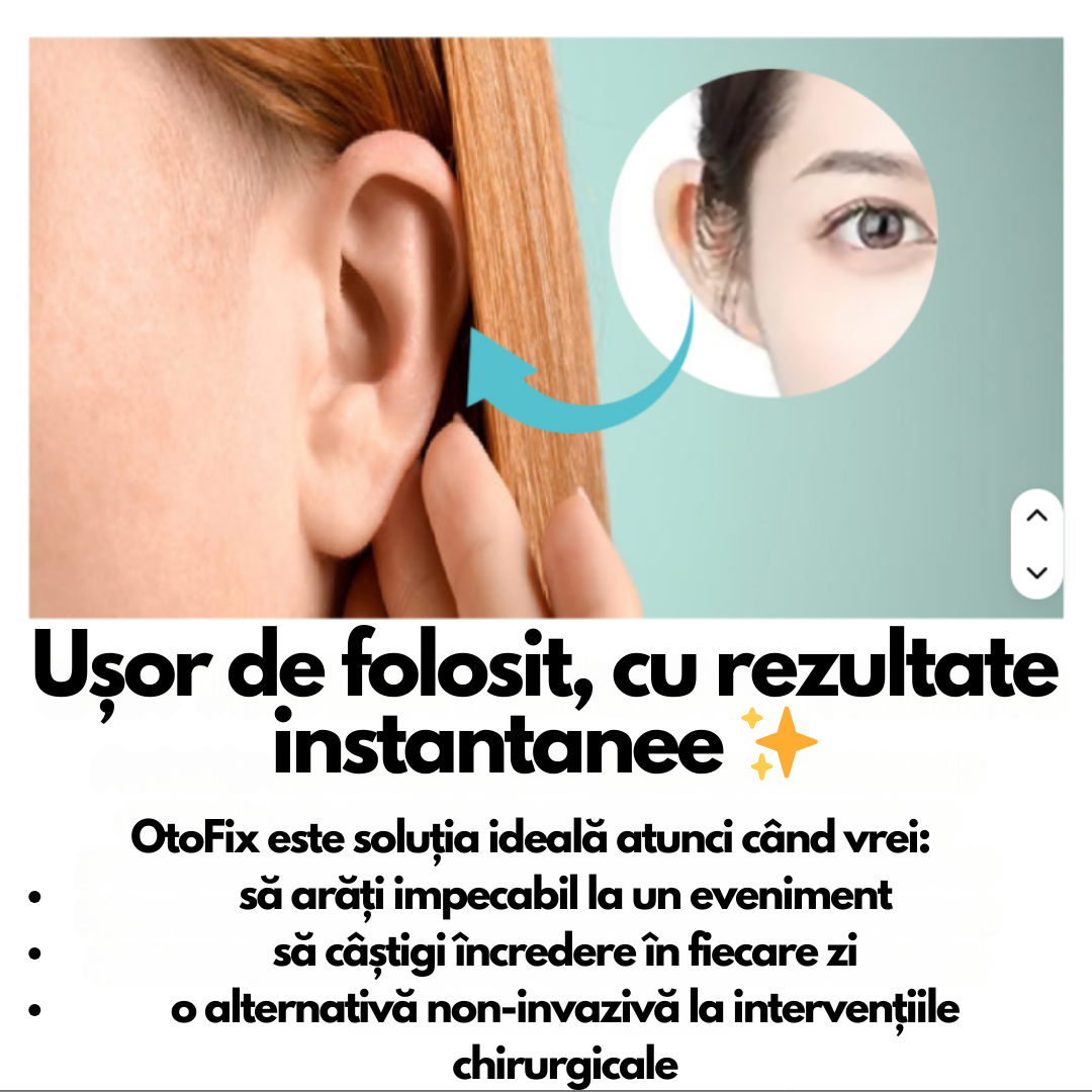 👂OtoFix – Plasturi Corectori pentru Urechi