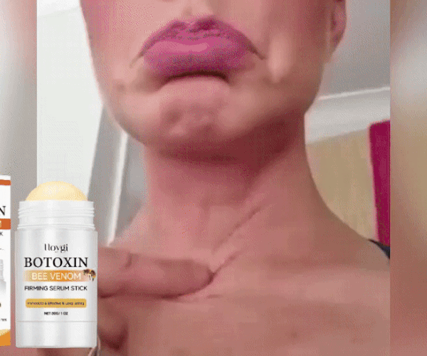 Stick Roll-On Anti-RIDURI