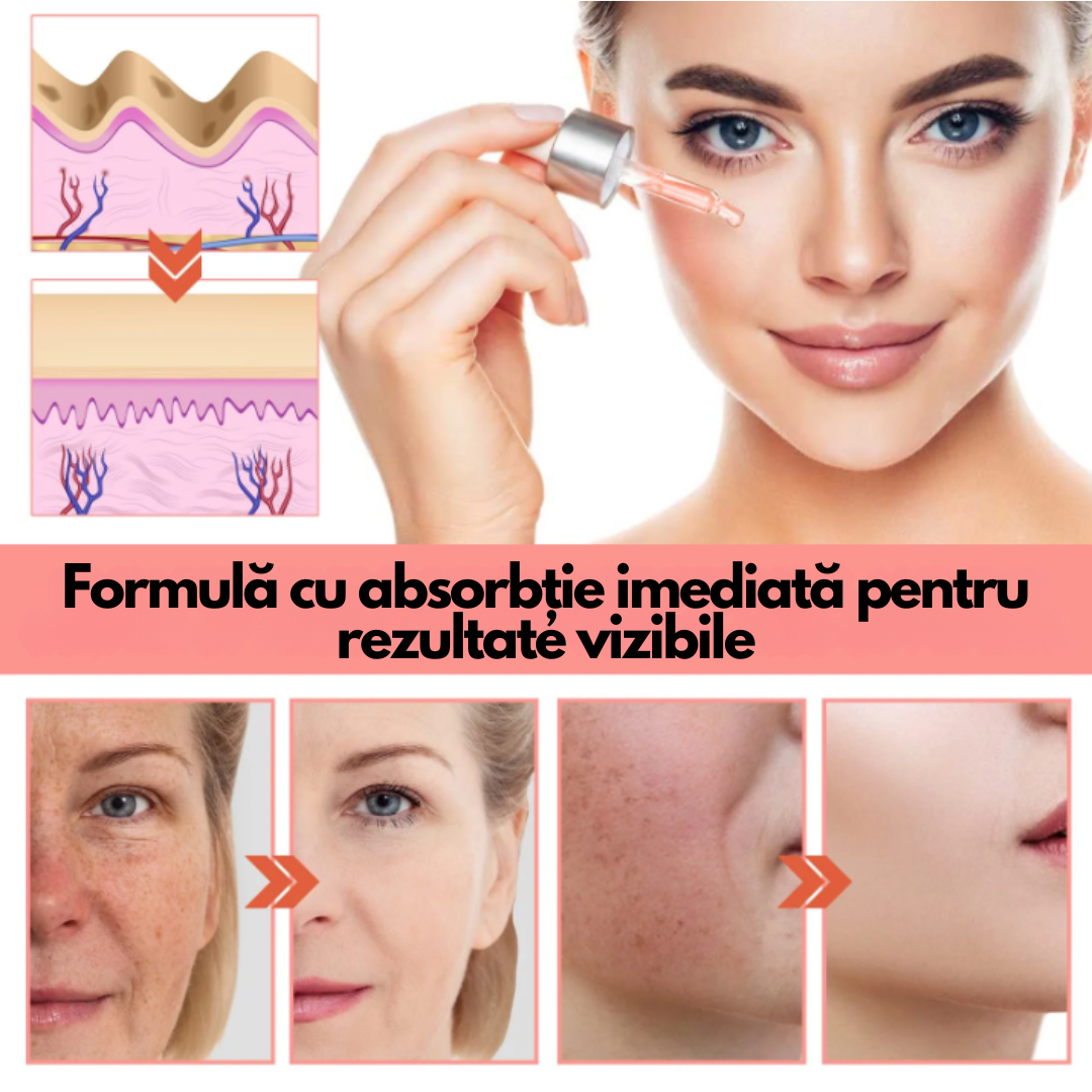 Ser Facial Anti-Pete cu Niacinamidă 5%